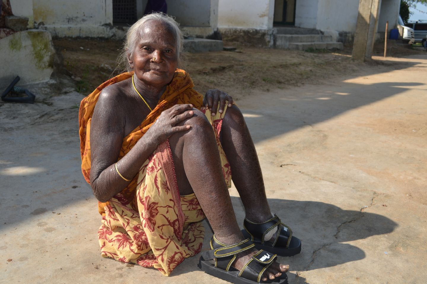 Brighter Futures — Leprosy